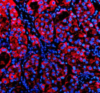 Immunofluorescent staining of P4HA1 using anti-P4HA1 antibody (red). P4HA1 was detected in a paraffi