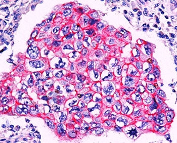 Beta Catenin Antibody