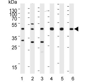 Western blot testing of 1) human HeLa, 2) human HT-29, 3) human Jurkat, 4) mouse brain, 5) mouse cer