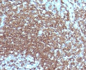 IHC testing of FFPE human tonsil with ICAM3 antibody.