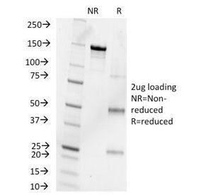 Progesterone Antibody