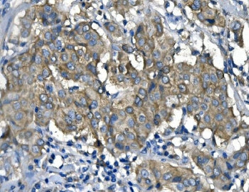 RENT1 / hUPF1 Antibody