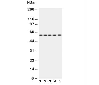 Western blot testing of Occludin antibody and Lane 1: SW620; 2: COLO320; 3: A549; 4: 293T; 5: U87. P