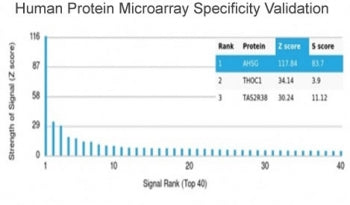 Analysis of HuProt(TM) microarray containing more than 19,000 full-length human proteins using Fetui