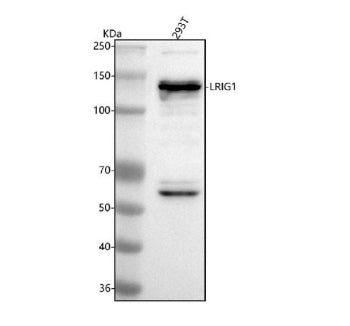 Western blot analysis of LRIG1 using anti-LRIG1 antibody. Lane 1: human 293T whole cell lysates. Aft