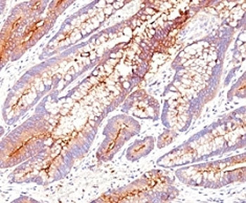 CEA Antibody / Carcinoembryonic Antigen