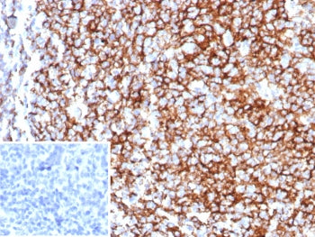 IHC staining of FFPE human tonsil tissue with CD35 antibody (clone rCR1/8597). Inset: PBS used in pl