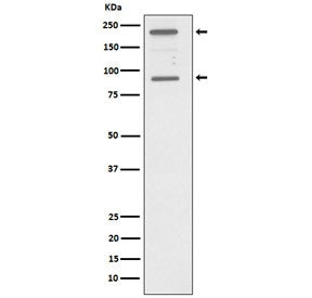 Western blot testing of human HepG2 cell lysate with C4A antibody. Predicted molecular weight: 193-2