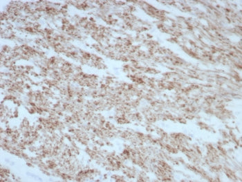 IHC staining of FFPE human smooth muscle tissue with DES antibody (clone rDES/8846). HIER: boil tiss