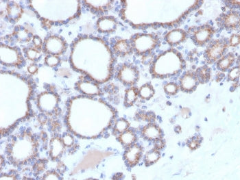 DBC2 Antibody / RHOBTB2