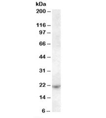 Western blot testing of Jurkat cell lysate with ASF1A antibody at 1ug/ml. Predicted molecular weight