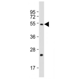 Western blot testing of FADS2 antibody at 1:2000 + human liver lysate. Predicted molecular weight ~5