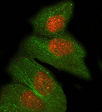 Immunofluorescent staining of FFPE human A431 cells with PRDM8 antibody (red) and Alpha Tubulin mAb 