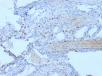 IHC staining of FFPE human prostate tissue with PCGF3 antibody (clone PCRP-PCGF3-1D5) HIER: boil tis