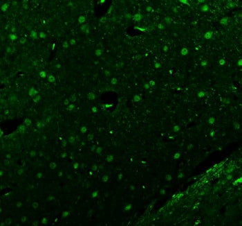 Immunofluorescent staining of FFPE rat brain tissue with Islet 1 antibody (green). HIER: steam secti