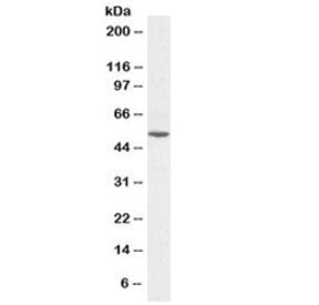 Western blot testing of human liver lysate with Alanine aminotransferase 1 antibody at 0.1ug/ml. Pre