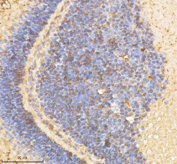 IHC staining of FFPE zebrafish eye tissue with Psmd2 antibody, HRP-labeled secondary and DAB substra