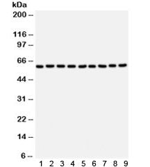 Western blot testing of 1) rat brain, 2) mouse brain, 3) rat skeletal muscle, 4) mouse skeletal musc