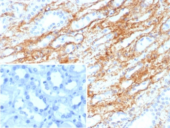 IHC staining of FFPE human kidney tissue with Collagen IV antibody (clone COL4/8657R). Inset: PBS us
