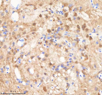 IHC staining of zebrafish Smarca4a protein using Zebrafish Smarca4a antibody, HRP-labeled secondary 