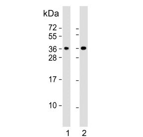 Western blot testing of human 1) HeLa and 2) Jurkat cell lysate with CLNS1A antibody. Predicted mole