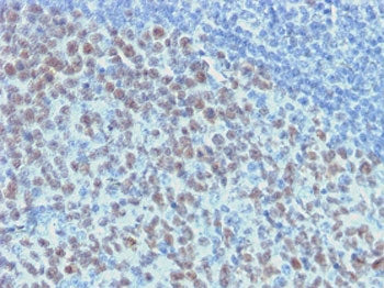 IHC testing of FFPE human tonsil with recombinant Bcl6 antibody (clone ARBC6-2R). Required HIER: boi