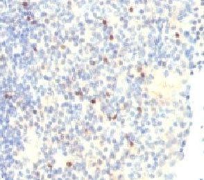 IHC analysis of FOXP3 antibody (clone FHBP3-1) and human tonsil tissue. Required HIER: boil tissue s