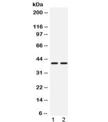 TXNL2 Antibody / GLRX3