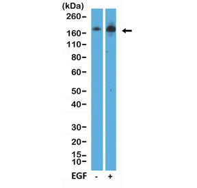 Western blot testing of lysate from human A431 cells, nontreated (-) or treated (+) with EGF, using 