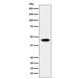 Western blot testing of human HEK293 cell lysate wit ADSS2 antibody. Predicted molecular weight ~50 