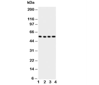 Western blot testing of Glut5 antbody; Lane 1: U87; 2: 293T; 3: HT1080; 4: SW620 cell lysate. Expect
