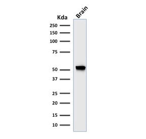 Western blot testing of human brain lysate with recombinant Glial Fibrillary Acidic Protein antibody