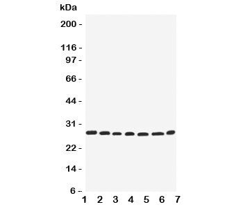 Western blot testing of EIF6 antbody; Lane 1: rat liver; 2: (r) kidney; 3: human COLO320; 4: (h) SW6