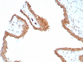 IHC staining of FFPE human prostate tissue with GLUL antibody (clone GLUL/8517R). HIER: boil tissue 
