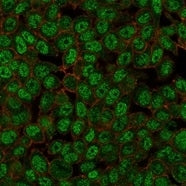 Immunofluorescent staining of PFA-fixed human HeLa cells using ZMYM3 antibody (green, clone PCRP-ZMY