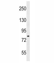 IKK antibody western blot analysis in A549 lysate. Predicted molecular weight ~85 kDa.