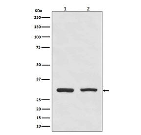 Western blot testing of human 1) HeLa and 2) Raji cell lysate with Bcl10 antibody. Expected molecula