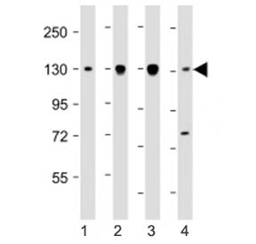 Western blot testing of Dnmt3a antibody at 1:2000: Lane 1) human T47D, 2) CCRF-CEM, 3) Jurkat and 4)