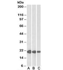 Western blot testing of human [A], mouse [B] and rat [C] heart lysate with CSRP3 antibody at 0.01ug/
