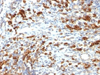 CD79a Antibody