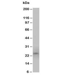 Western blot testing of PrP antibody and U87 cell lysate (human glioma). Expected molecular weight: 