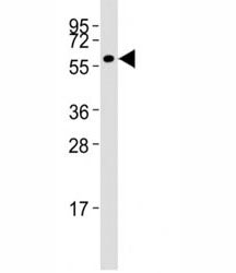 Western blot testing of MMP14 antibody at 1:1000 dilution + HT-1080 lysate; Predicted molecular weig