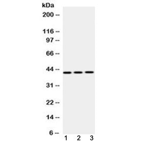 EBP1 Antibody / ErbB3-binding protein 1