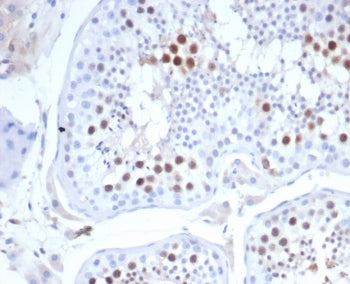 KIF2C Antibody / MCAK