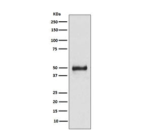 Western blot testing of human HaCat cell lysate with Keratin 8 antibody. Predicted molecular weight 