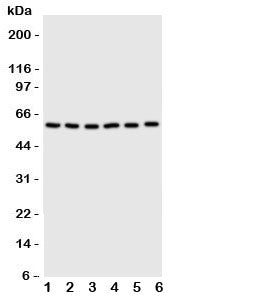 Western blot testing of SCYL antbody on Lane 1: U87; 2: HeLa; 3: 293T; 4: MCF-7; 5: COLO320; 6: HE10