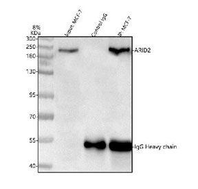 Immunoprecipitation of ARID2 protein from 500ug of human MCF7 whole cell lysate with 2ug of ARID2 an