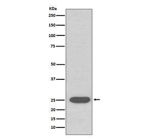 Superoxide Dismutase 2 Antibody / SOD2