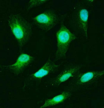 USP25 Antibody