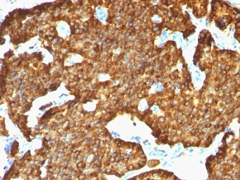 Chromogranin A Antibody